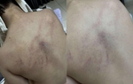 Vụ bé gái 4 tuổi bị kéo lê, ném vào tường: Tạm đình chỉ 2 giáo viên để phục vụ điều tra