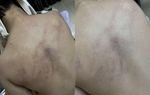 Vụ bé gái 4 tuổi bị đánh, ném vào tường: Cục Bà mẹ và Trẻ em đề nghị xử lý nghiêm