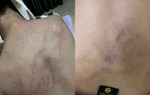 Xác minh thông tin bé gái 4 tuổi bị cô giáo đánh, kéo lê, ném vào tường