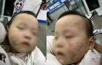Tạm giữ bảo mẫu khiến bé gái 1 tuổi ở Bắc Ninh bị thương khi đi học 