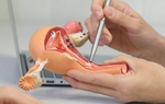 Bác sĩ thắt ống dẫn trứng nhưng không tư vấn cho bệnh nhân
