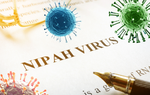 Chuyên gia: Cần cảnh giác với virus Nipah nhưng không nên quá lo lắng