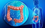 Ung thư đại tràng trở thành nguyên nhân hàng đầu gây tử vong do ung thư ở người dưới 50 tuổi tại Mỹ