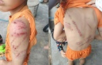 Đánh con bầm tím khắp người, người cha bị phạt 7,5 triệu đồng