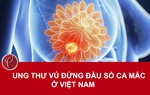 Ung thư vú đứng đầu số ca mắc ung thư ở Việt Nam