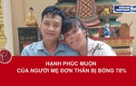 Hạnh phúc muộn của người mẹ đơn thân bị bỏng 78%