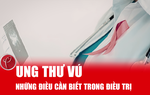 Những điều cần biết trong điều trị ung thư vú