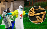 4 điểm bất thường khó kiểm soát dịch Ebola