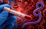Bộ Y tế kích hoạt các biện pháp ứng phó nguy cơ Ebola xâm nhập Việt Nam
