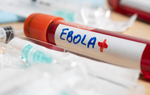 Bộ Y tế yêu cầu chủ động phòng chống bệnh do vi rút Ebola