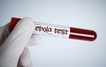 Việt Nam chủ động ứng phó nguy cơ dịch Ebola từ bên ngoài