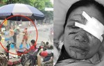 Khởi tố phụ nữ bán hải sản dùng vòi rửa xe xịt người bán rau gây thương tích