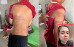 Nghệ An: Mẹ tố cha ruột bạo hành con trai 10 tuổi