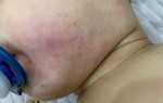Công an Hà Nội tiếp nhận tố giác việc bé 2 tuổi bị tổn thương sau buổi học tại trung tâm Little Star