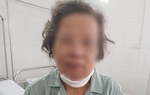 Đi khám sâu răng, phát hiện bị ung thư hiếm gặp giai đoạn 4