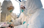 Phát hiện virus SARS-CoV-2 có trong nước mắt của bệnh nhân