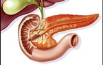 Bệnh viêm tụy có thể gây ra những biến chứng vô cùng nguy hiểm