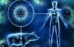 Cúm lợn (H1N1): Triệu chứng, nguyên nhân, chẩn đoán và điều trị 