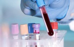 Việt Nam chưa sử dụng test kit xét nghiệm nhanh  