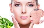 Cách trị sẹo rỗ lâu năm an toàn hiệu quả nhất từ nguyên liệu dễ kiếm