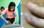 May khẩu trang miễn phí bị phồng rộp tay, vợ được chồng và người thân khích lệ 