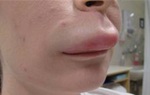 Phù mạch là gì, có nguy hiểm không?