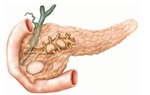 Viêm tụy mãn tính là gì? Những điều cần biết về bệnh viêm tụy mãn tính