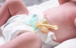 Hình ảnh rốn trẻ sơ sinh bị nhiễm trùng khiến nhiều mẹ sửng sốt 