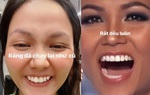 Bị nói làm răng sứ, H'Hen Niê có cách đáp trả nhẹ nhàng nhưng đầy thuyết phục