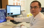 Người phụ nữ bị giun sán làm tổ trong não vì một lần ăn thịt lợn theo cách tai hại