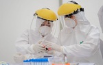 Vì sao xét nghiệm test nhanh có thể âm tính giả hoặc dương tính giả?