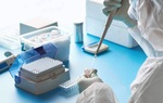 Bộ Kit xét nghiệm của Việt Nam được Tổ chức Y tế Thế giới công nhận đạt chuẩn quốc tế