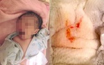 Mẹ cứu con gái 1 tuổi thoát chết nhờ phát hiện sớm vệt máu dính ở tã