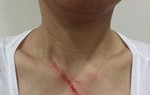 Nhắc không nhổ bậy trong thang máy, 1 phụ nữ bị đánh túi bụi