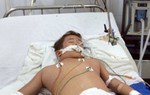 Bé 10 tuổi thoát chết nhờ tăng áp máy thở