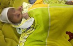 Chữa đau mắt bằng kinh nghiệm dân gian, bé 15 ngày tuổi suýt bị mù