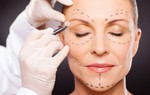 Người phụ nữ không thể tự chủ đi vệ sinh sau phẫu thuật thẩm mỹ