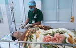 Hy hữu người phụ nữ mang thai cả trong và ngoài tử cung