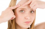 Những nguyên nhân gây mụn trứng cá không nên bỏ qua