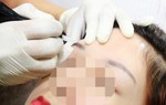 3 biến chứng thường gặp khi phun xăm lông mày