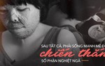 Cô gái bị chồng tẩm xăng đốt chia sẻ về khát vọng sống