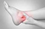 Phụ nữ tiền mãn kinh chớ xem thường bệnh gout