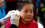 Ráy tai nhiều có thể khiến trẻ chậm nói