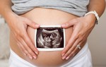 5 thời điểm siêu âm thai không thể bỏ qua