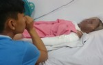 Nấu cháo rồi ngủ quên, người mẹ trẻ bị bỏng 36% cơ thể