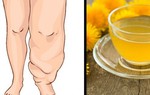 10 thực phẩm và đồ uống giúp cơ thể không bị phù nề