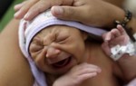 Chuyên gia bày cách phòng dị tật đầu nhỏ ở trẻ do Zika