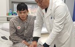 BV TƯ Quân đội 108: Lần đầu tiên nối mạch máu vi phẫu không cần kim chỉ