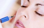 Mờ mắt sau khi tiêm filler nâng mũi ở spa