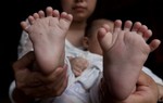 Cha cậu bé 31 ngón dừng quyên góp, tự kiếm tiền phẫu thuật cho con